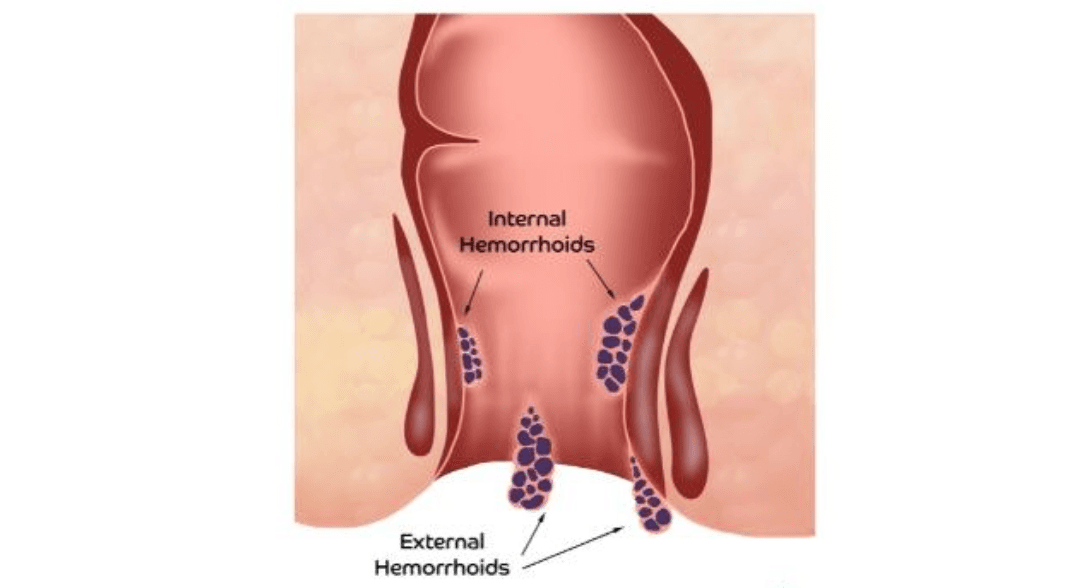 Customizable Layouts image used.