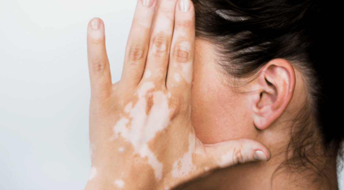 Progress Tracking image used.