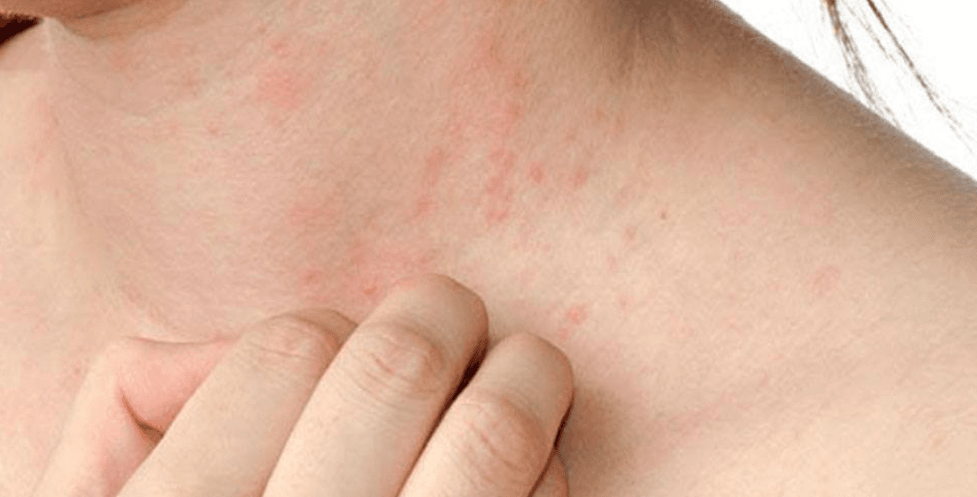 Progress Tracking image used.