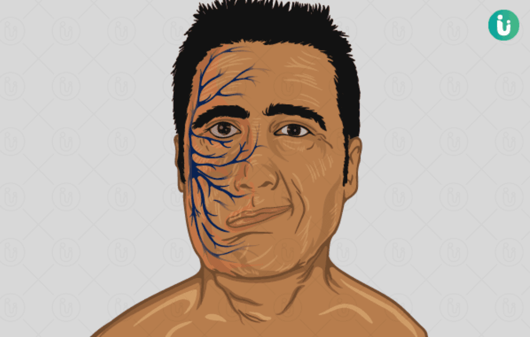 Progress Tracking image used.